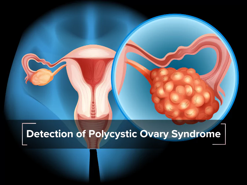 PCOS Detection Project